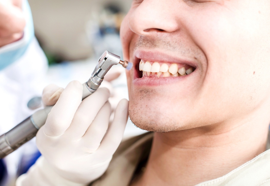 Traditional Braces in La Crête